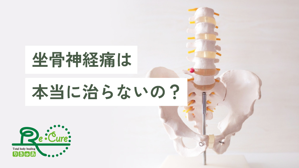 銀座・横浜の整体Recureの座骨神経痛の原因と治療方法