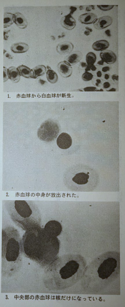 白血球整体銀座