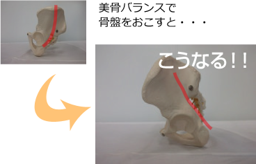 美骨バランスで骨盤をおこすと・・・こうなる！！
